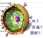 在治疗时前列腺囊肿该吃